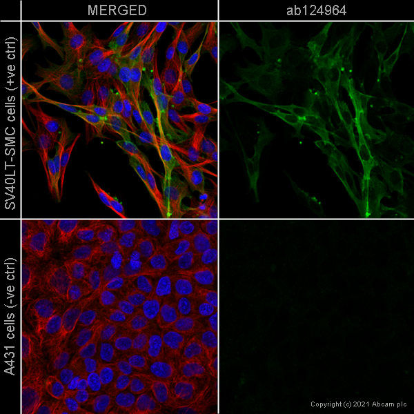 Anti-Alpha smooth muscle Actin antibody [ab124964], EPR5368