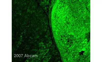 Gfp Antibody Ab13970 Immunocytochemistry Immunofluorescence Img118092