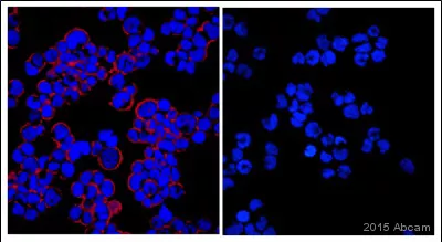 Gfp Antibody Ab13970 Immunocytochemistry Immunofluorescence Img93195