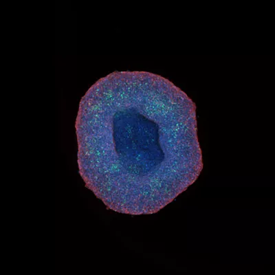 Hepg2 Spheroid Acquired At 10x Magnification