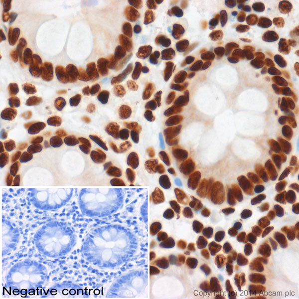 Anti-Histone H3 (acetyl K27) antibody - ChIP Grade(AB4729)