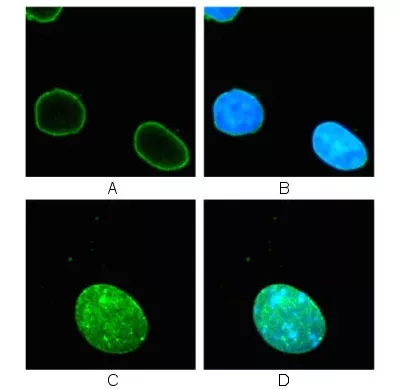 Immunocytochemistry Immunofluorescence Anti Lamin B1 Antibody Nuclear Envelope Marker Ab16048 Image03