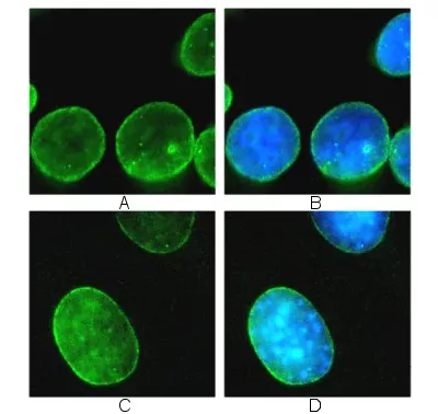 Immunocytochemistry Immunofluorescence Anti Lamin B1 Antibody Nuclear Envelope Marker Ab16048 Image05