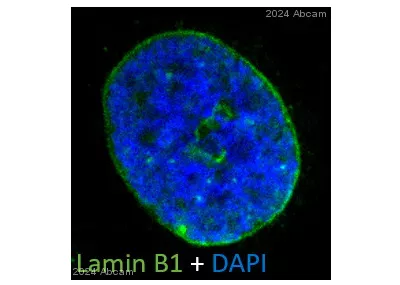 Immunocytochemistry Immunofluorescence Anti Lamin B1 Antibody Nuclear Envelope Marker Ab16048 Image06