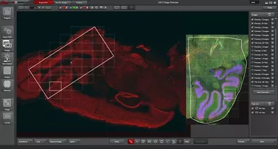 Overview Scan Of A Three Color Immunofluorescently Stained Mouse Brain Section