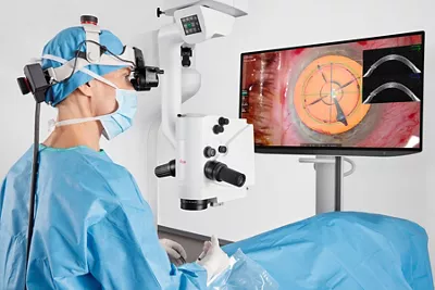 Cataract MyVeo Kid21756114