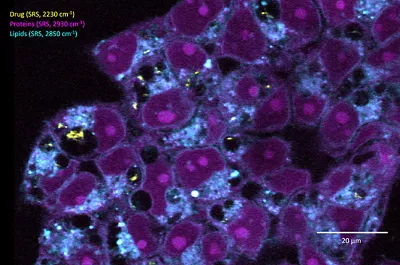 Drug In Cells 02 Kid21758013