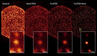 From Confocal To TauXTED Xtend Crop Kid21764610