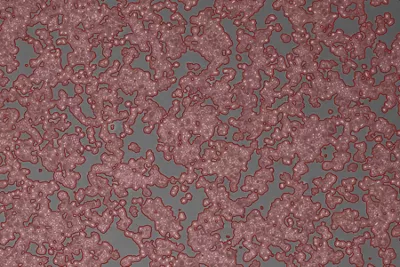 Hela4 Cells Right Kid21764933