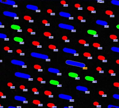 LAS X 2D Analysis Software: Sample classification trainable for your specific needs