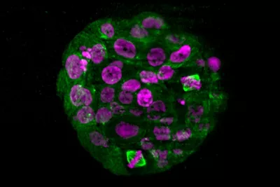 Live Mammary Epithelial Spheroid Kid21766507