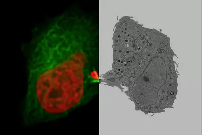 Mammalian Cells Expressing H2B MCherry And AlphaTubulin MEGFP Kid21767589