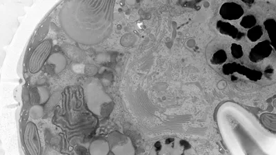 Micrograph Of A Dinoflagellate Cell Kid21767838