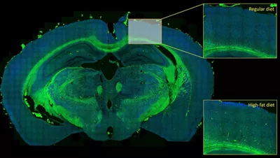 Mouse Brain Navigator 03 Kid21768014