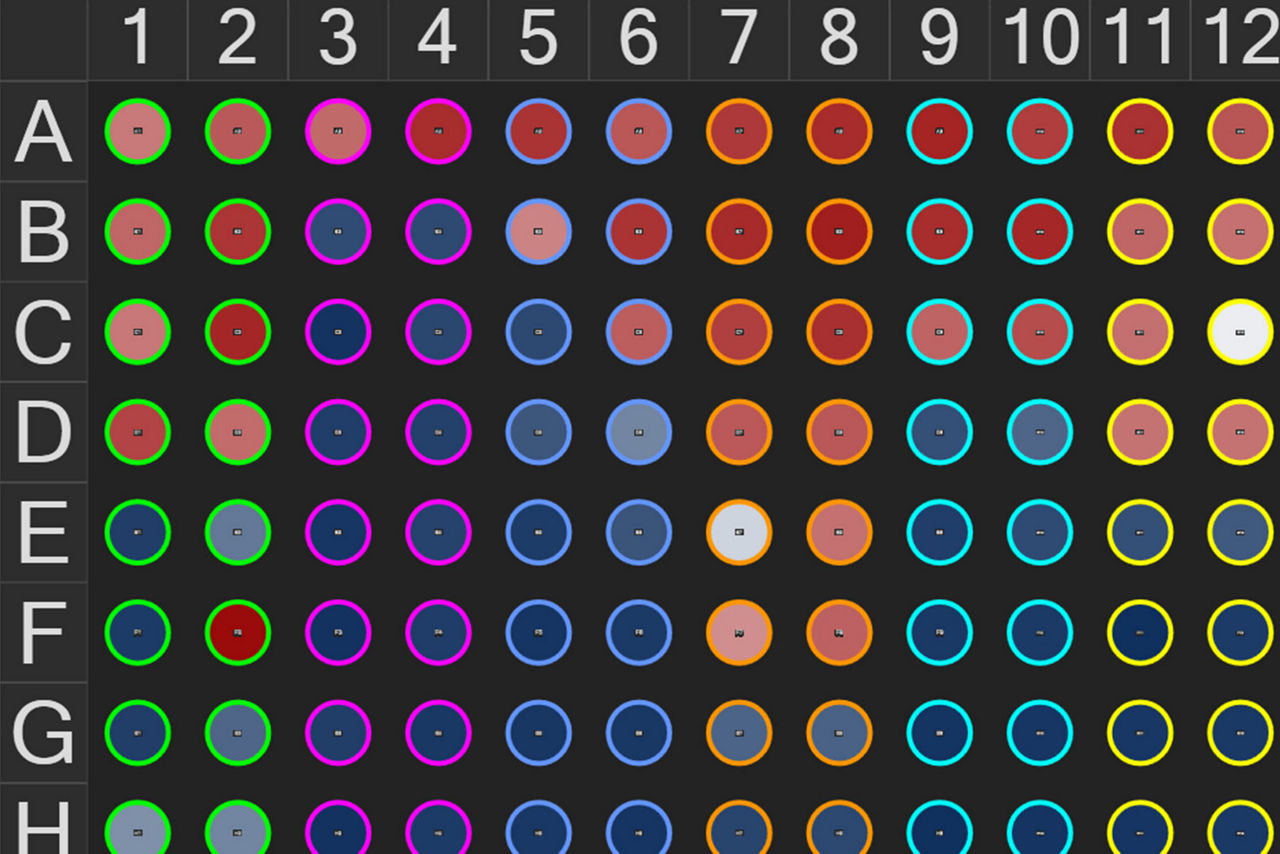 Análisis optimizado con Aivia Launchpad 