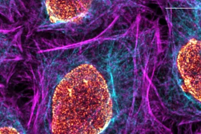 Multicolor Fixed Sample Confocal Kid21768045