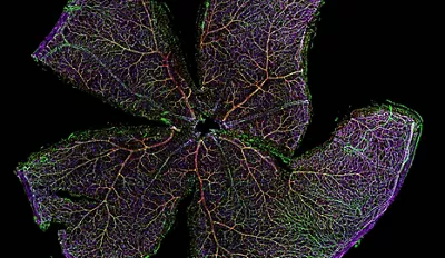 High-resolution imaging