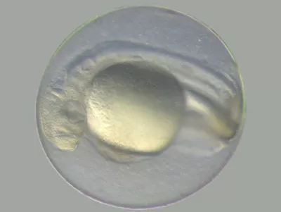 Zebrafish Egg After 01 Kid21777395