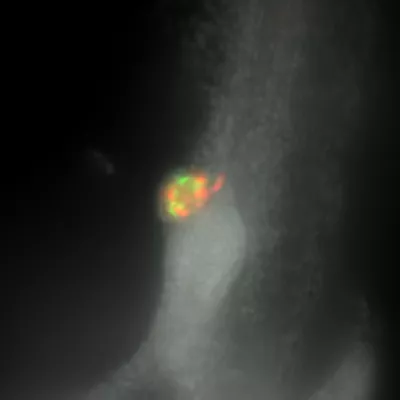 Zebrafish Pancreas DAPI GFP Kid21777383 2