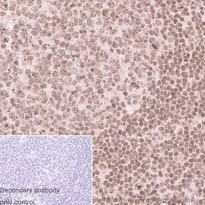 Antigen Retrieval Buffer 100x Citrate Buffer Ab93678 Immunohistochemistry Formalin Pfa Fixed Paraffin Embedded S AYt7fVuEN7