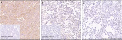 Antigen Retrieval Buffer 100x Citrate Buffer Ab93678 Immunohistochemistry Formalin Pfa Fixed Paraffin Embedded S VoWLaSahRv