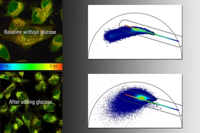 Combining Multiphoton Img Kid21756467