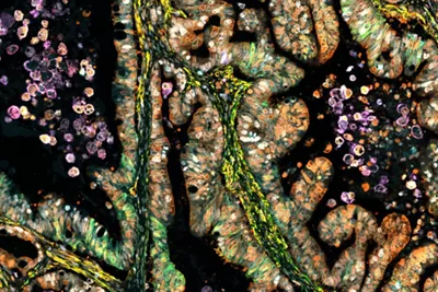 Crystal Clear Imaging