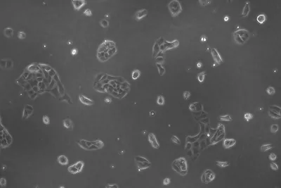 Lmd Hela Cells 05 Kid21766572