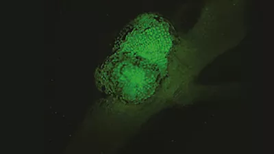 Mz10f Fluorescence Benefit Focus 02 Kid21768116