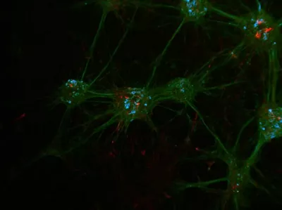 Neuronal Cell Culture Stained With Dapi